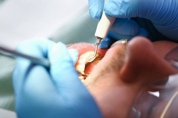 Best Weekend Emergency Dentist in Pontiac, IL