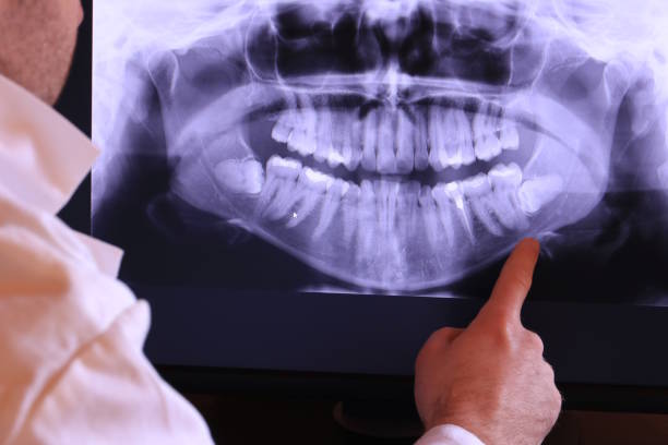 Best Emergency Tooth Extraction in Pontiac, IL