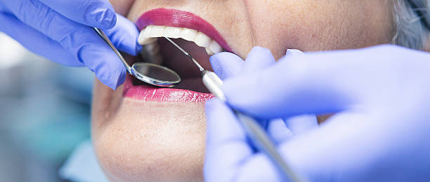 Best Emergency Broken Tooth Repair in Pontiac, IL
